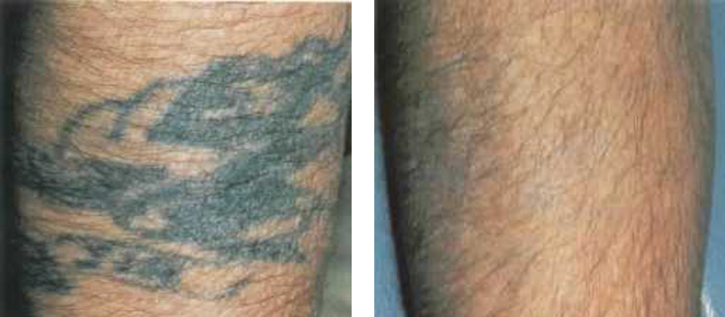Tattoo Leg Copy 1
